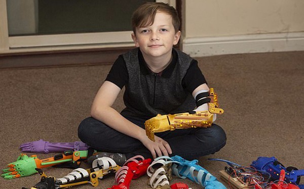 感動！英父親為無臂兒子3D打印9只個性仿生臂