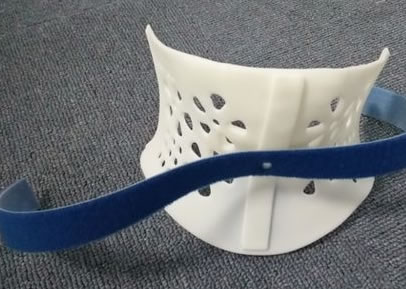 醫(yī)療3D打印機定制矯正器(圖2) 醫(yī)療3D打印機定制矯正器(圖2)