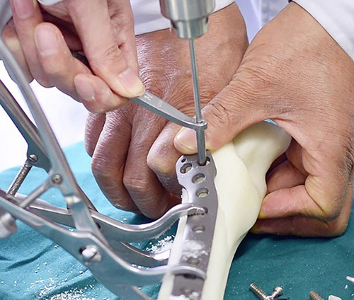 3D打印技術在骨科的實際應用有哪些？(圖2)